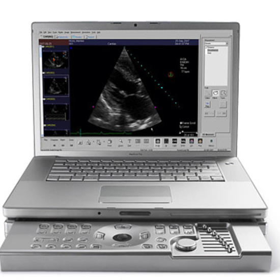 Ультразвуковой сканер Siemens Acuson P50